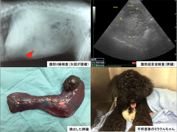 脾臓腫瘤（過形成）２