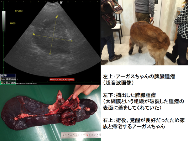 脾臓腫瘤（過形成）２