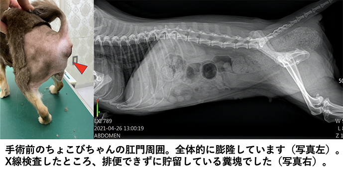 会陰ヘルニア２